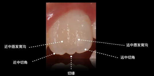 孩子才刚换牙，牙齿就呈锯齿状是正常的吗？